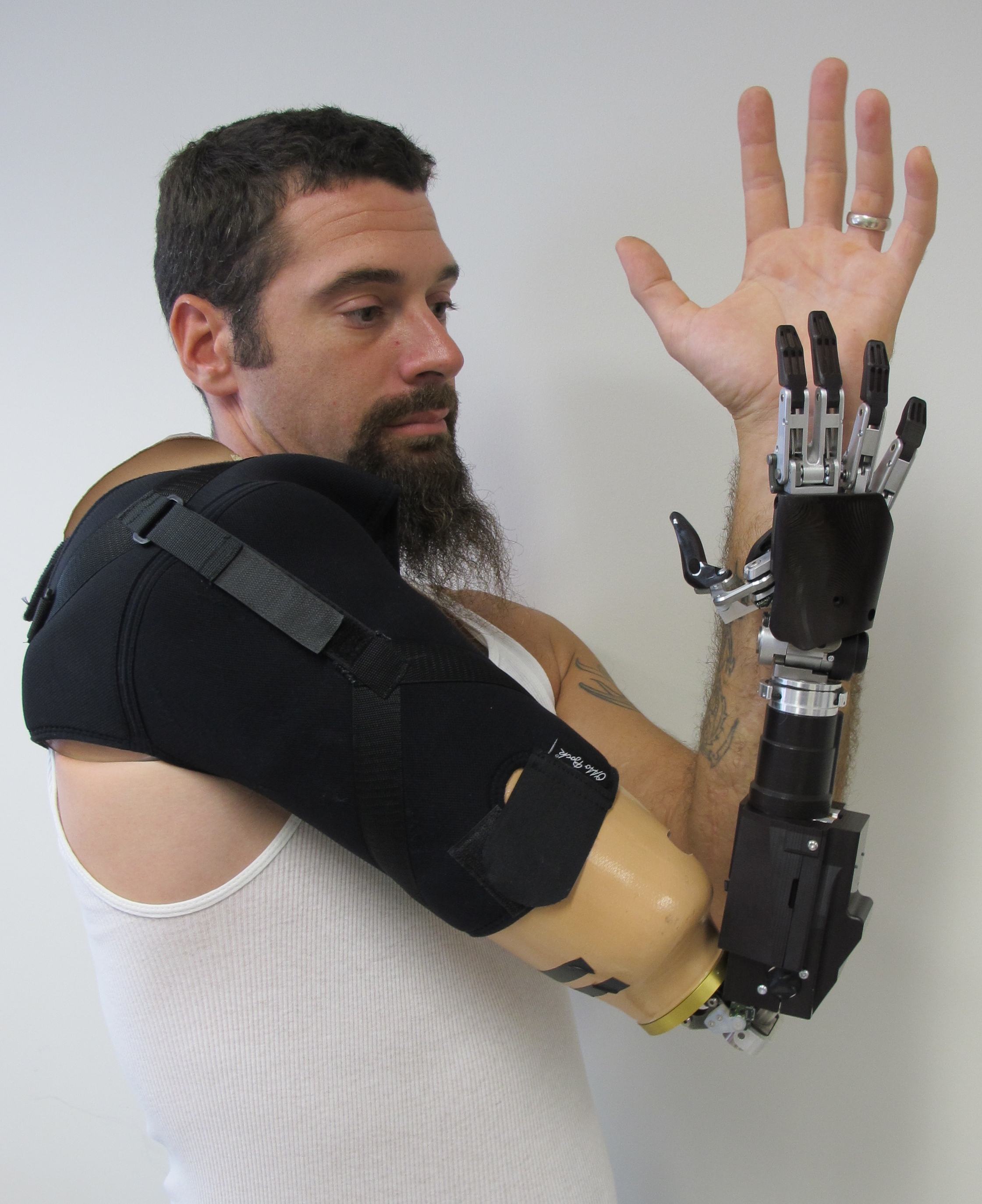 Самый дорогой протез. Джесси Салливан бионические протезы. Бионические протезы bebionic. Протез руки. Технологичный протез руки.