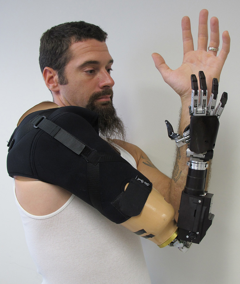 Image of Prosthetics Artificial arm with hook and forearm