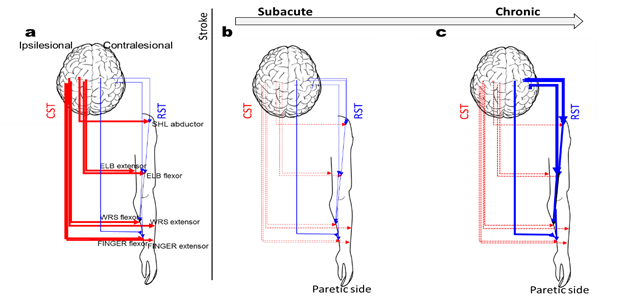 Severe-to-moderate impairment