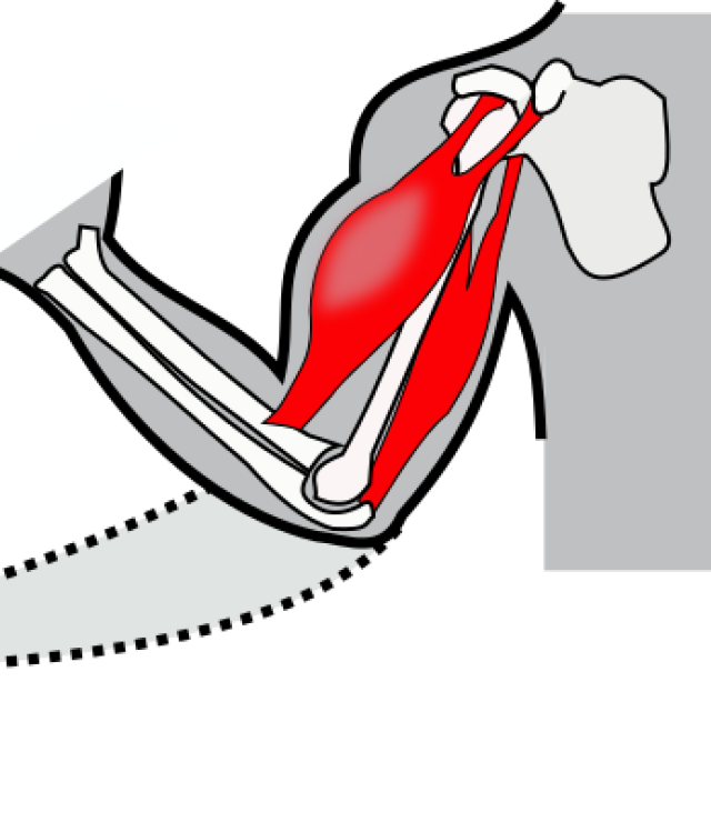 spasticity