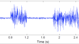 What EMG Signal may look like!