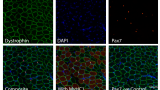 Muscle Stem Cells