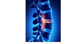 a graphic of a spine in blue shades with a few vertebrae in red